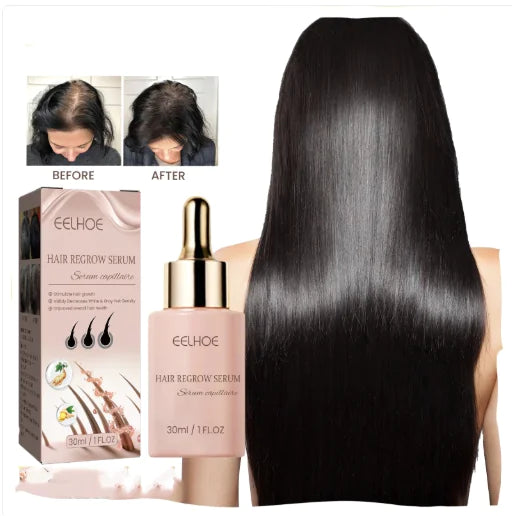 Hair Dense Essence – Anti-Hair Loss &amp; Nourishing Oil