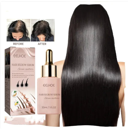 Hair Dense Essence – Anti-Hair Loss &amp; Nourishing Oil