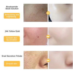 24K Gold Hyaluronic