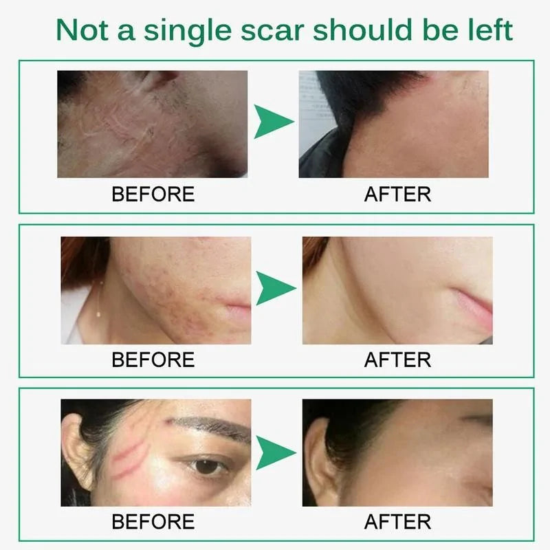 Skin Rejuvenation Cream