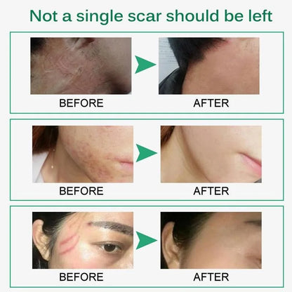 Skin Rejuvenation Cream