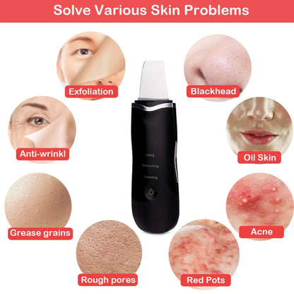 Ultrasonic Pore Cleaner - Deep Facial Cleansing